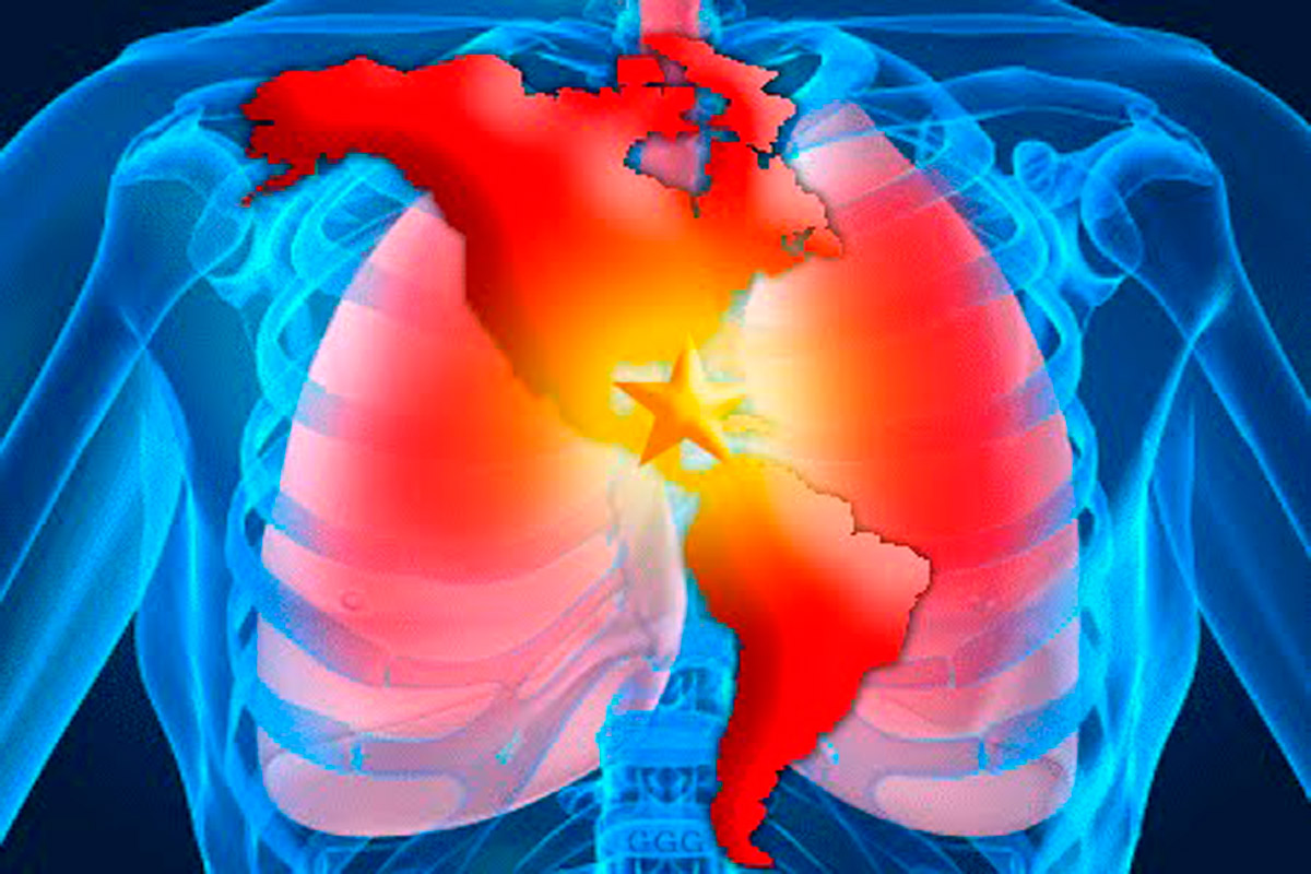 Cuba quiere estar libre de tuberculosis