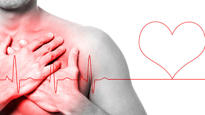 Frente a un infarto, los cardiólogos recomiendan cinco pasos fundamentales