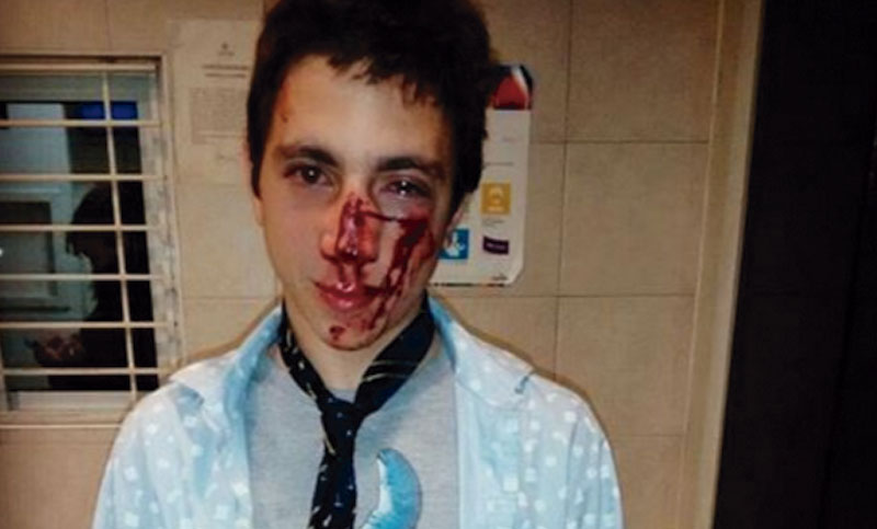 Una patota golpeó brutalmente a un joven de 22 años a la salida de un boliche