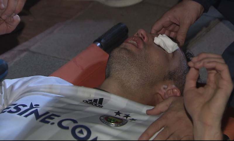 El holandés Van Persie sufrió una grave lesión y casi pierde un ojo