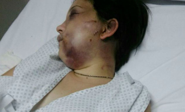 Mujer golpeada por el anestesista: «Me decía que me quería matar»