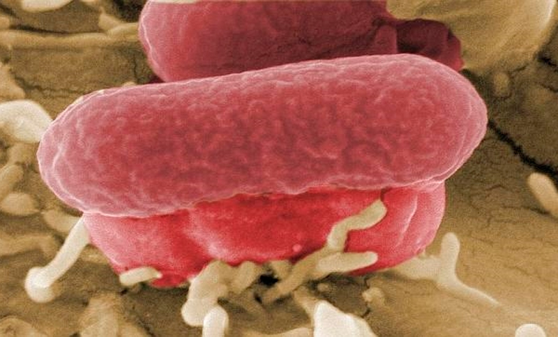 La OMS urge hallar nuevos antibióticos para doce “superbacterias”