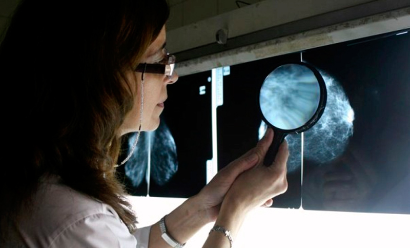 En Argentina hay cinco mil nuevos casos por año de cáncer de cuello uterino