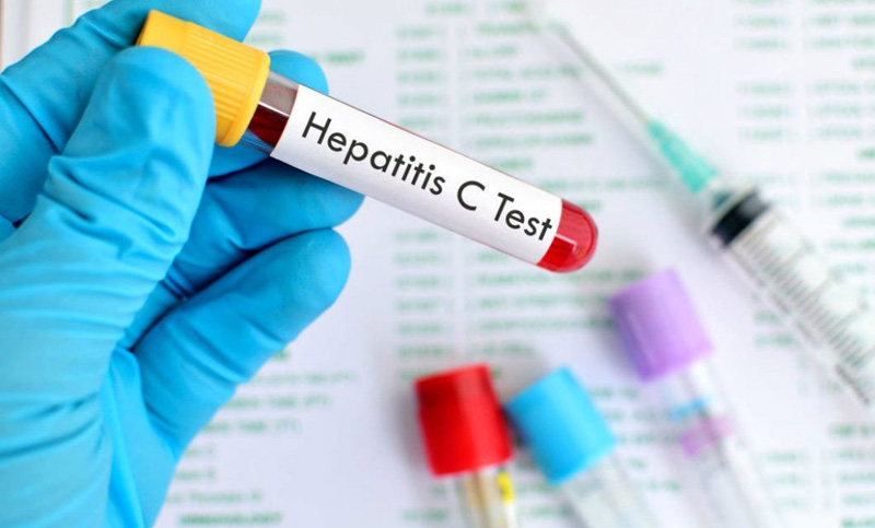 Hepatitis C: habrá menos infectados, aunque más muertes en Argentina