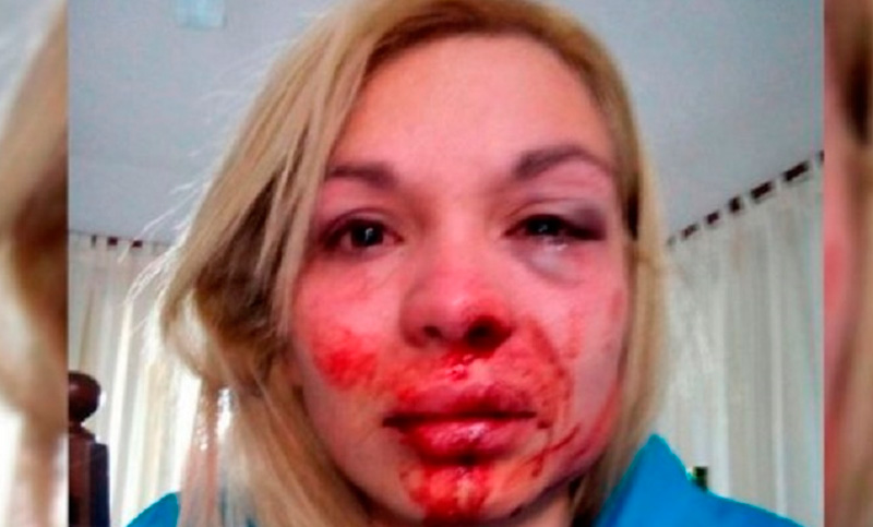 Reconquista: una mujer fue brutalmente golpeada por su pareja