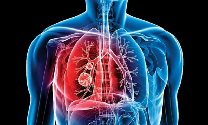 La OMS pide «acabar con todos los casos» de tuberculosis