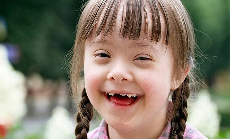 Día del Síndrome de Down, una condición que afecta a 40 mil personas en Argentina