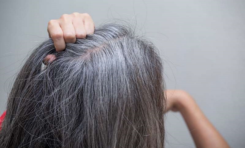 Una investigación revela por primera vez cómo el estrés puede aumentar el cabello blanco