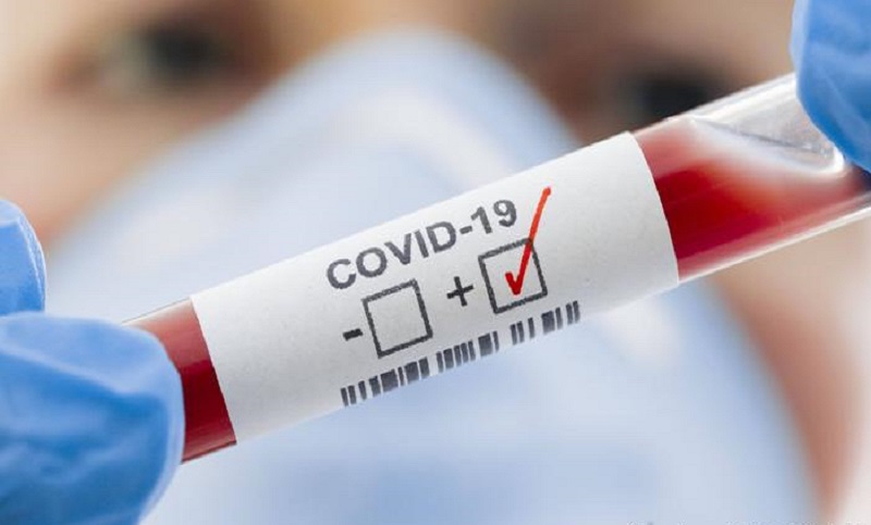 Estiman que el pico de casos de coronavirus podría darse dentro de 45 días 
