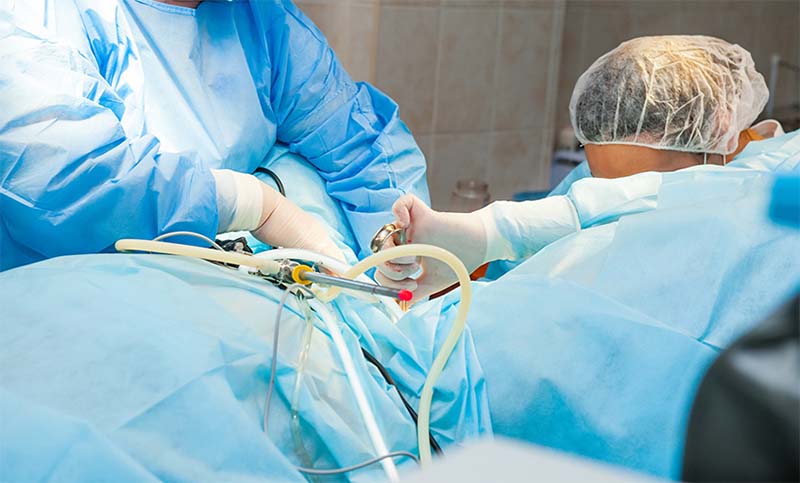 Profesionales de Salud Pública municipal operaron el corazón de un feto de 8 meses