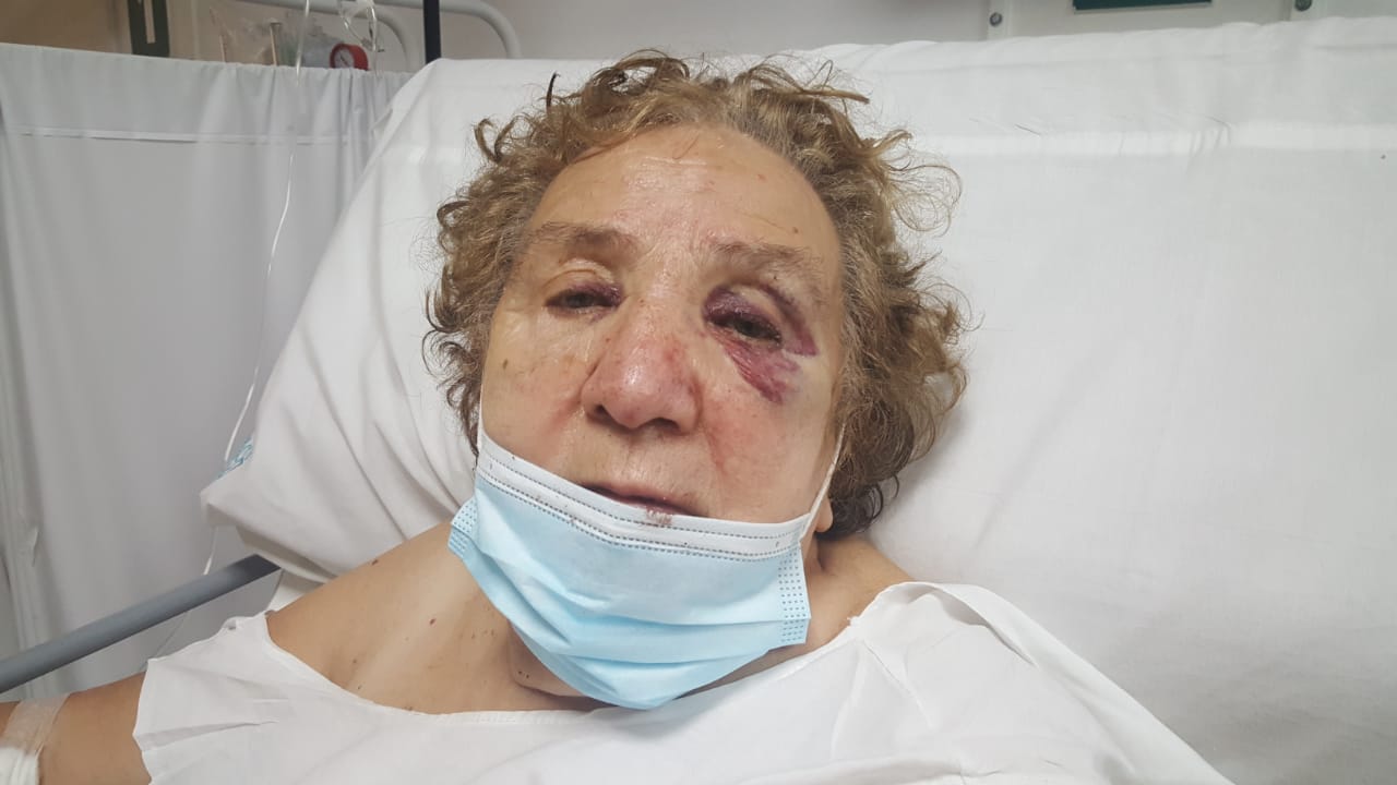 Anciana fue brutalmente golpeada cuando iba a visitar a su hija