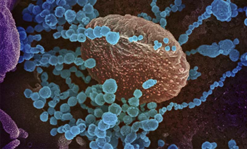 Coronavirus: mutaciones en la variante «Lambda» preocupan a los científicos
