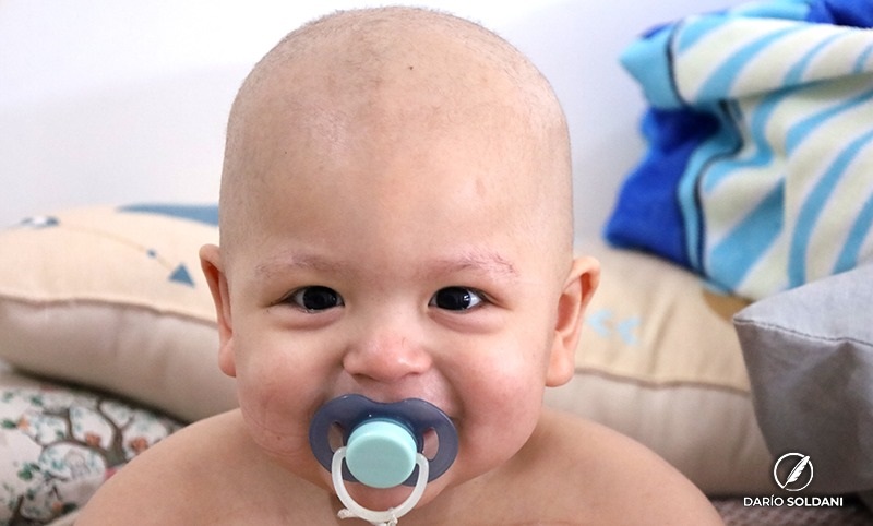 Todos por Félix: la historia de un bebé de 20 meses que da batalla a la leucemia